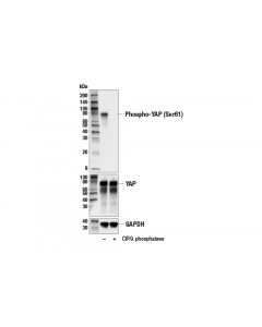 Cell Signaling Phospho-YAP (Ser61) Antib; CSIG-75784S