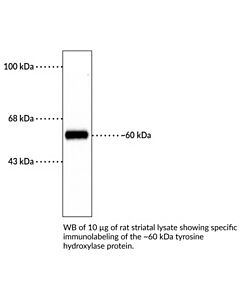 Cayman Tyrosine Hydroxylase Polyclonal Antibody; Size- 1 Ea