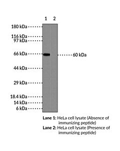 Cayman Nf-B (P65) Polyclonal Antibody (Aa 2-17); Size- 1 Ea