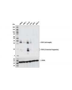Cell Signaling CTGF (E2W5M) Rabbit mAb -; CSIG-10095S