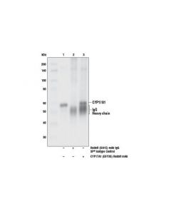 Cell Signaling CYP17A1 (E6Y3S) Rabbit mA; CSIG-10443S