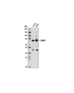 Cell Signaling LIMD1 Antibody - CSIG (Ad; CSIG-13245S