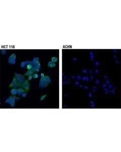 Cell Signaling SAV1 (D6M6X) Rabbit mAb -; CSIG-13301S