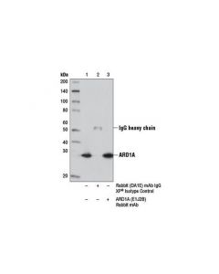 Cell Signaling ARD1A (E1J2B) Rabbit mAb ; CSIG-13357S