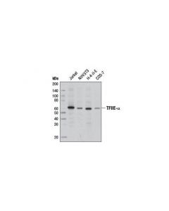 Cell Signaling TFIIE-alpha Antibody - CS; CSIG-13375S