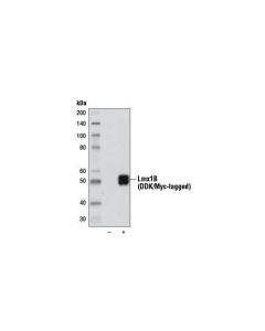 Cell Signaling Lmx1B (D1E2) Rabbit mAb -; CSIG-13457S