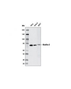 Cell Signaling Kindlin-2 Antibody - CSIG; CSIG-13562S