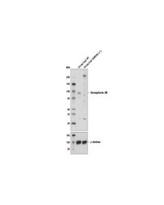 Cell Signaling Semaphorin 4b Antibody