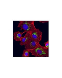 Cell Signaling PHB2 (E1Z5A) Rabbit mAb -; CSIG-14085S