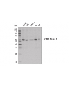 Cell Signaling P70 S6 Kinase 2 Antibody