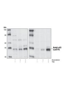 Cell Signaling Acetyl-P53 (Lys379) Antibody