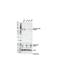 Cell Signaling Non-phospho (Active) YAP; CSIG-29495S