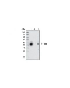 Cell Signaling Lkb1 (27d10) Rabbit mAb