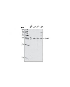 Cell Signaling Pim-1 (C93f2) Rabbit mAb
