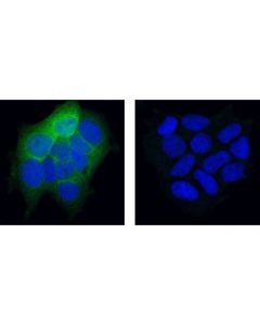 Cell Signaling Phospho-Cofilin (Ser3) (77g2) Rabbit mAb
