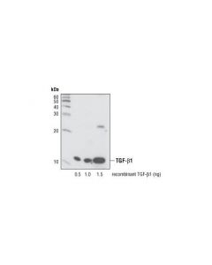 Cell Signaling Tgf-Beta (56e4) Rabbit mAb