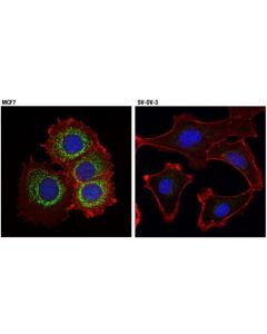 Cell Signaling Mcl-1 (D5v5l) Rabbit mAb