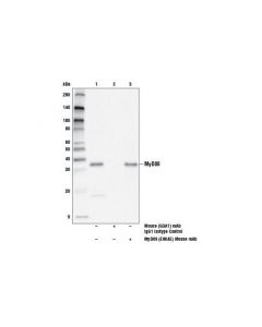Cell Signaling Myd88 (E9k4e) Mouse mAb