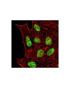 Cell Signaling Ash2l (D93f6) Xp Rabbit mAb