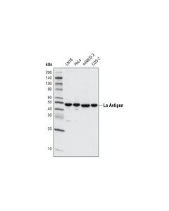 Cell Signaling La Antigen (D19b3) Rabbit mAb