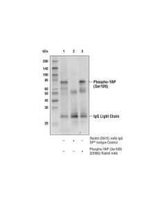 Cell Signaling Phospho-YAP (Ser109) (E5I; CSIG-53749S