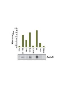 Cell Signaling PathScan Total Cyclin D1 ; CSIG-7918C
