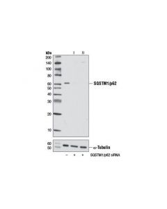 Cell Signaling SQSTM1/p62 (D5E2) Rabbit ; CSIG-8025T