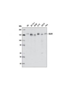 Cell Signaling ULK1 (D8H5) Rabbit mAb - ; CSIG-8054T