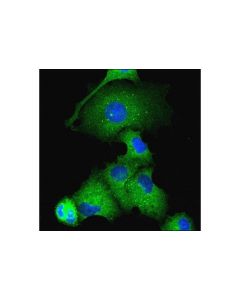 Cell Signaling Atg16L1 (D6D5) Rabbit mAb; CSIG-8089T