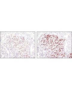 Cell Signaling Signalstain Boost Ihc Detection Reagent (Hrp, Rabbit)