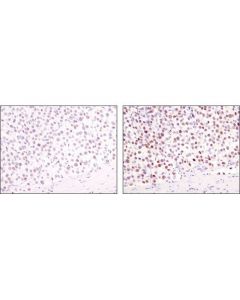 Cell Signaling Signalstain Boost Ihc Detection Reagent (Hrp, Mouse)