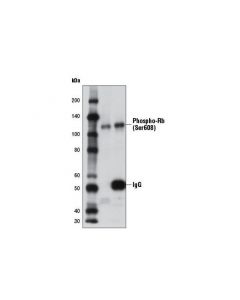 Cell Signaling Phospho-Rb (Ser608) (D10f2) Rabbit mAb