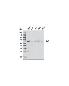 Cell Signaling Atg7 (D12B11) Rabbit mAb ; CSIG-8558T