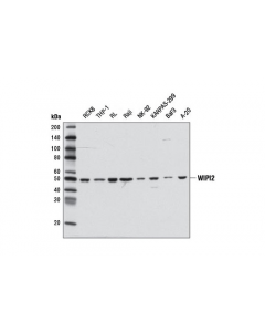 Cell Signaling WIPI2 Antibody - CSIG (Ad; CSIG-8567T