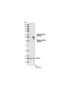 Cell Signaling Phospho-Gsk-3alpha/Beta (Ser21/9) (37f11) Rabbit mAb (Gsk-3alpha Preferred)