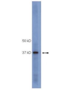Millipore Anti-Socs1 Antibody, Clone 4h1
