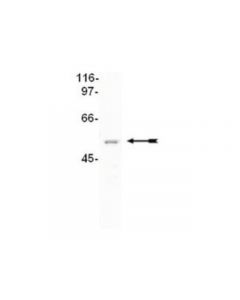 Millipore Anti-Cugbp2 Antibody, Clone 1h2