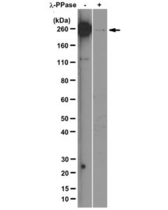 Millipore Anti-Rna Polymerase Ii Subunit B1 (Phospho-Ctd Ser-5) Antibody,