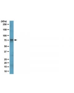 Millipore Anti-Brutons Tyrosine Kinase (Btk) Antibody, Clone 10d11