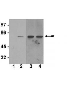 Millipore Anti-Phospho-Akt1/Pkbalpha (Ser473) Antibody, Clone Sk703,