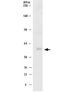 Millipore Anti-Src Antibody, Ct, Clone Nl19 | 04-772