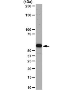 Millipore Anti-Akt1/Pkbalpha Antibody  Clone Aw24 | 04-796; MILL-04-796