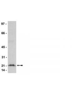 Millipore Anti-Rho (-A  -B  -C) Antibody  Clone 3l74  Rabbit Mono; MILL-04-822