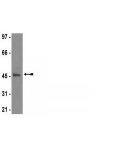 Millipore Anti-Jnk3/Sapk1b Antibody  Clone C05t  Rabbit Monoclona; MILL-04-893