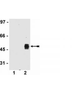 Millipore Anti-Ha Tag Antibody, Clone Dw2, Rabbit Monoclonal