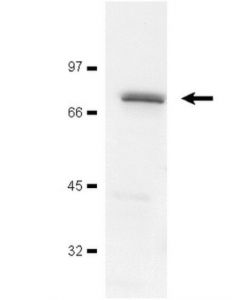 Millipore Anti-Zap-70 Antibody, Clone 2f3.2