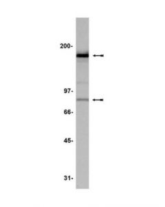 Millipore Anti-Pth/Pthrp Receptor Antibody, Clone 3d1.1