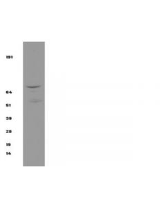 Millipore Anti-Ikkbeta Antibody, Clone 10ag2