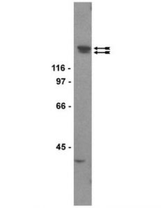 Millipore Anti-Kdr/Flk-1/Vegfr2 Antibody, Clone Ch-11