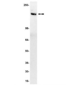 Millipore Anti-Tie2/Tek Antibody, Clone Ab33